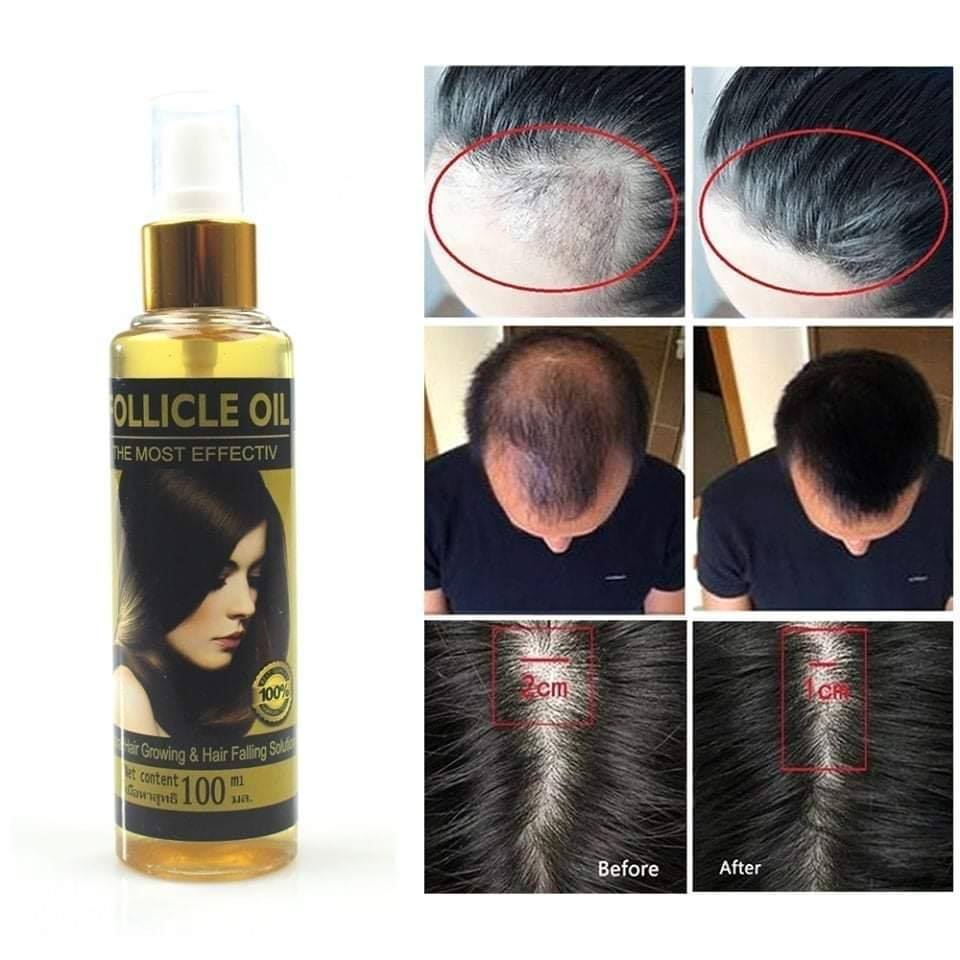 Follicle oil
