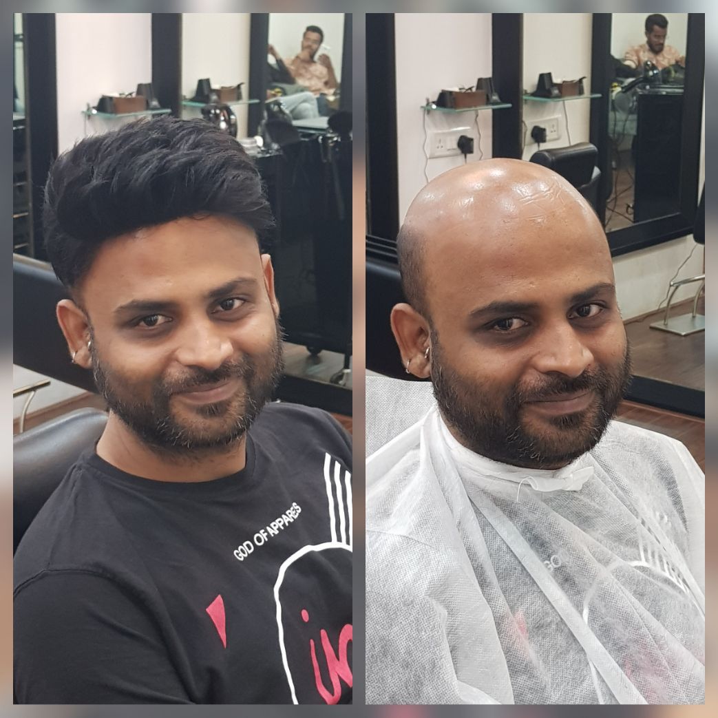 Hair Replacement